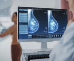 Novel AI boosts breast cancer detection in mammograms