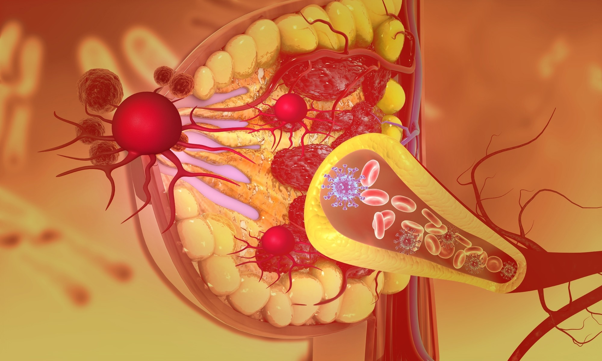 Study: Global, regional, and national analyses of the burden among adult women of breast cancer attributable to diet high in red meat from 1990 to 2021: longitudinal observational study. Image Credit: Explode / Shutterstock