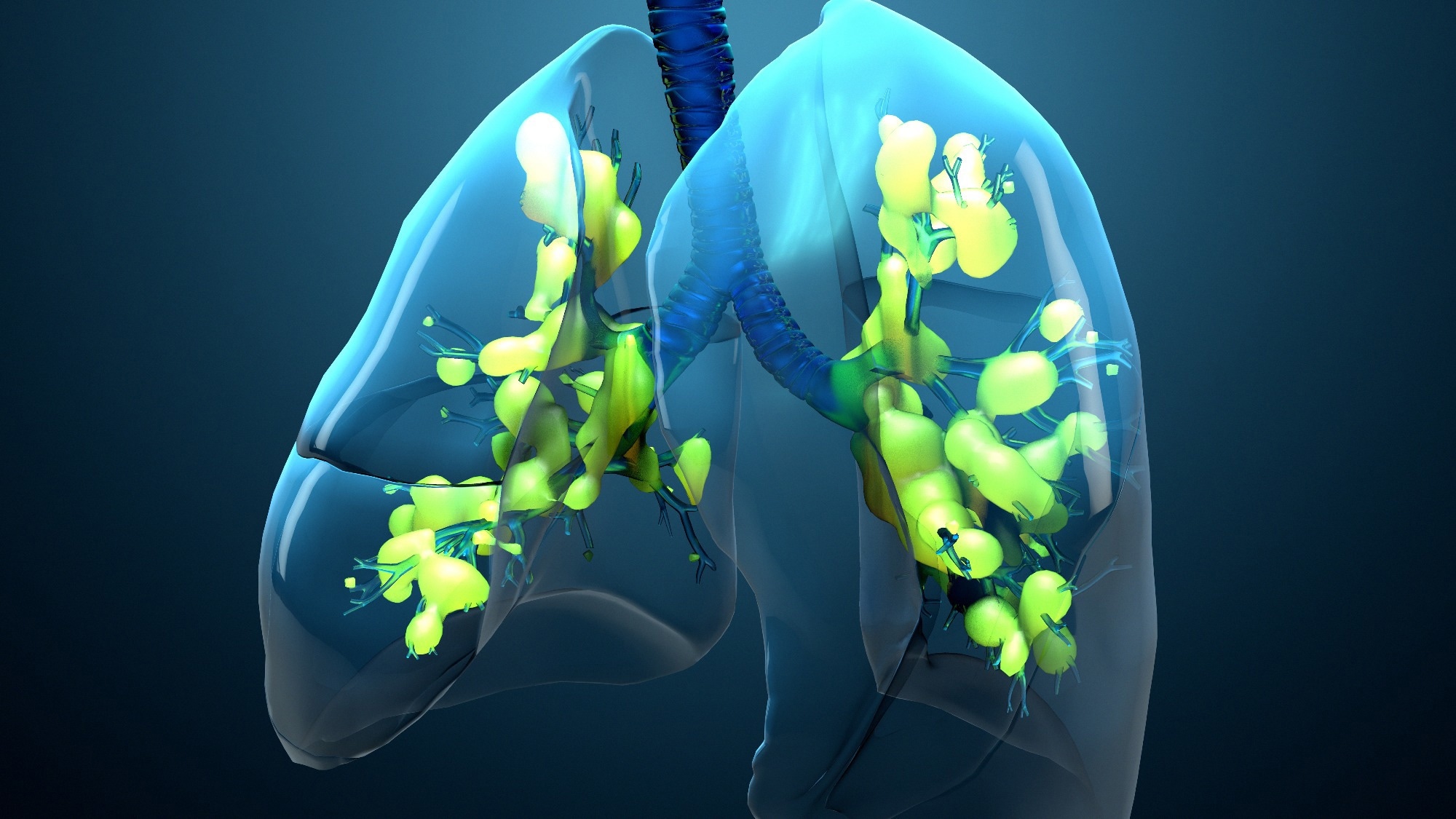 Review: Artificial intelligence and machine learning in acute respiratory distress syndrome management: recent advances. Image Credit: Design_Cells / Shutterstock
