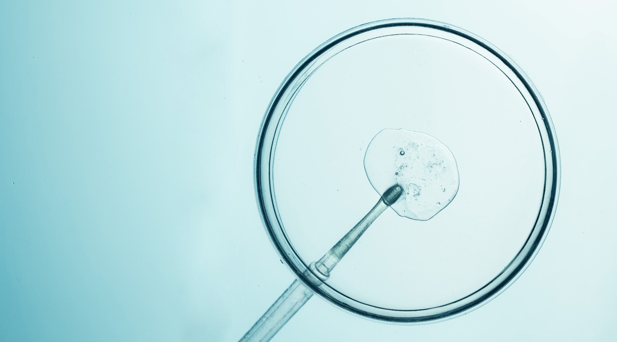 In vitro fertilization process with petri dish and pipette