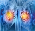 Respiratory viruses awaken dormant breast cancer cells and raise relapse risk