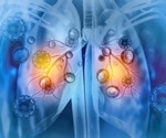 Respiratory viruses awaken dormant breast cancer cells and raise relapse risk