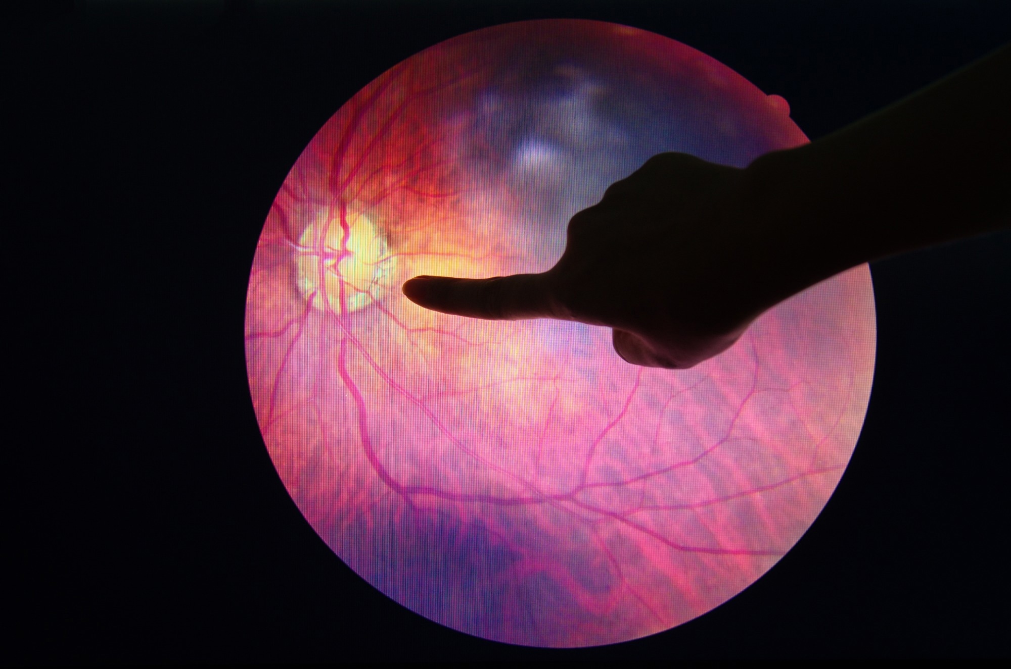 Trial: Diabetic Retinopathy Screening Among Federally Qualified Health Center Patients Using Point-of-Care AI. Image Credit: Anukool Manoton / Shutterstock