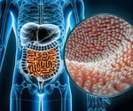 Global data show why gut microbiomes in industrialized regions look increasingly alike