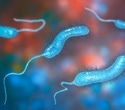 Dietary protein reshapes how cholera bacteria colonize the gut