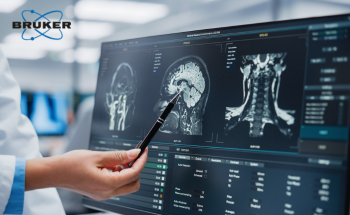 Decoding the Brain: Omics in Neuroscience