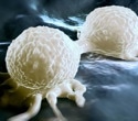 Study uncovers how aggressive breast cancer cells escape immune defenses