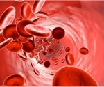 Exclusive licensing agreement accelerates PHD inhibitor development for anemia in CKD patients