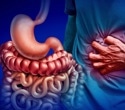 New method brings hope for personalized treatment of inflammatory bowel disease