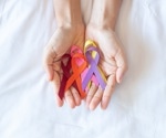 Chemotherapy may reduce HIV-infected T cells