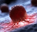 Novel immunotherapy targeting pancreatic cancer shows promising results in phase 1/2 trial