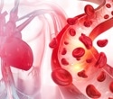 Clonal hematopoiesis linked to increased heart disease risk in cancer patients receiving treatment