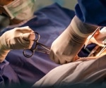 Risks of cesarean delivery are under reported, benefits overstated