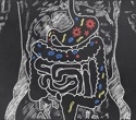 Gut bacteria compound during pregnancy protects offspring from fatty liver disease