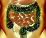 Gut bacteria compound during pregnancy protects offspring from fatty liver disease
