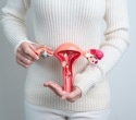 New menstrual blood test detects endometriosis with five times greater sensitivity