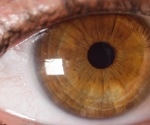Breakthrough $20 million OCT project aims to revolutionize eye health screening