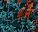 New research uncovers how coronavirus evades immune defense