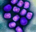 Blood viral load predicts severity of mpox symptoms